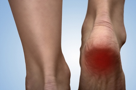Causas comuns de dor nos pés
